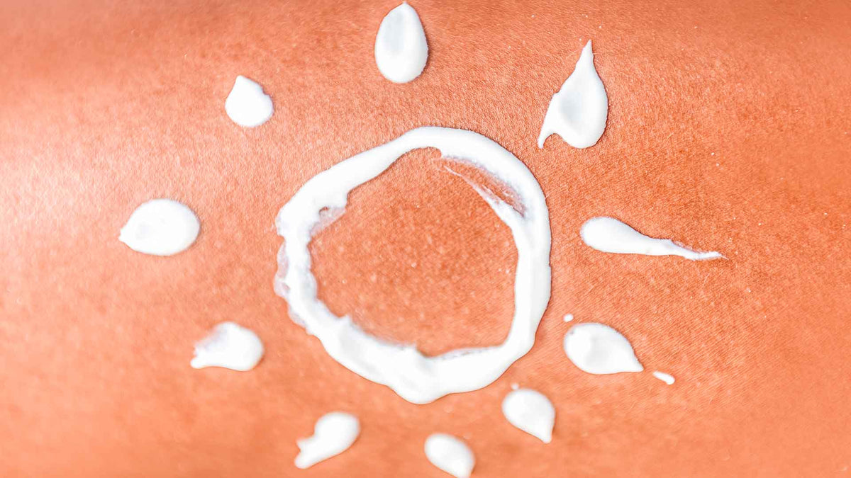 Nahaufnahme von einer menschlichen Hautfläche sichtlich mit Sonnenbrand. Mit Sonnencreme wurde eine Sonne mit Sonnenstrahlen draufgemalt